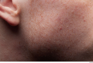 HD Face Skin Fergal cheek ear face skin pores skin…